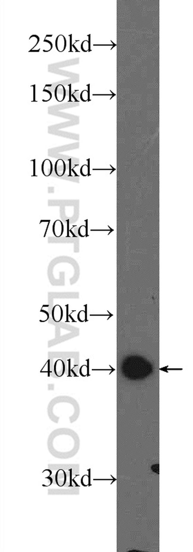 hIST1 Antibody in Western Blot (WB)