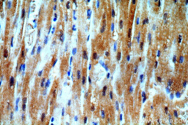 UBAC1 Antibody in Immunohistochemistry (Paraffin) (IHC (P))