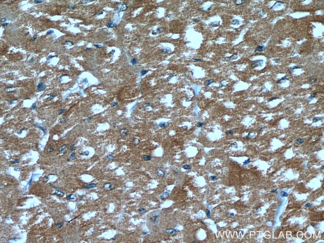 UBAC1 Antibody in Immunohistochemistry (Paraffin) (IHC (P))