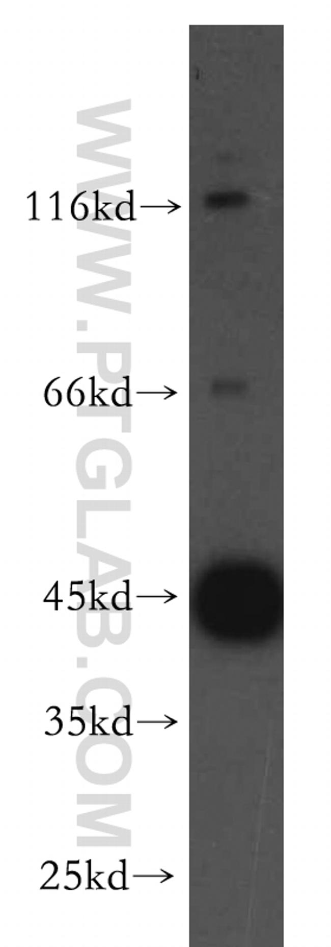 UBAC1 Antibody in Western Blot (WB)