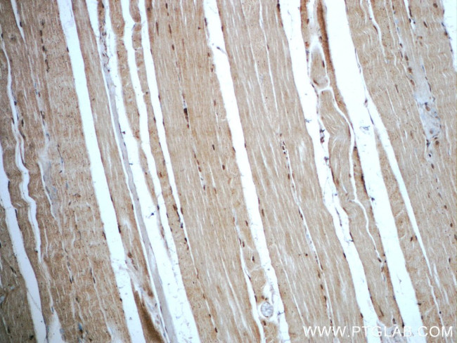 C14orf166 Antibody in Immunohistochemistry (Paraffin) (IHC (P))