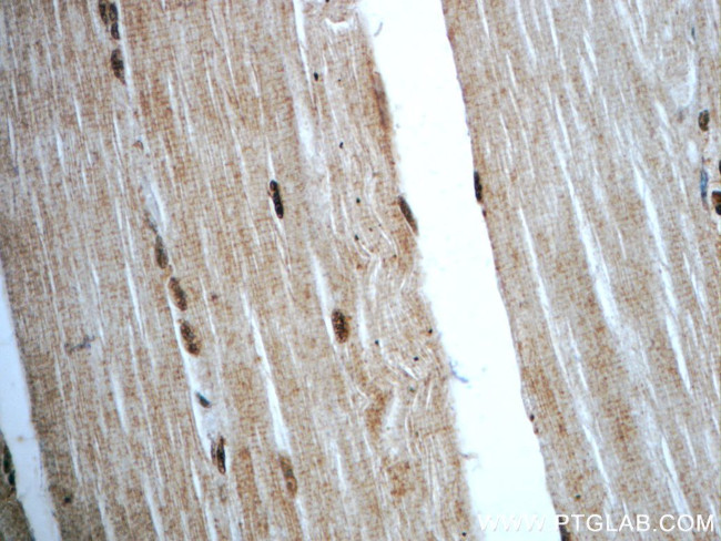 C14orf166 Antibody in Immunohistochemistry (Paraffin) (IHC (P))