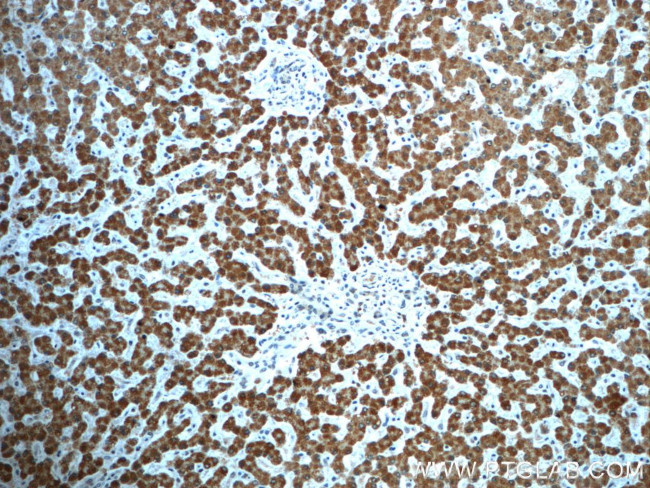 C14orf166 Antibody in Immunohistochemistry (Paraffin) (IHC (P))