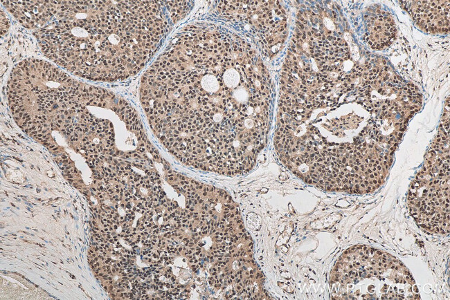 C14orf166 Antibody in Immunohistochemistry (Paraffin) (IHC (P))