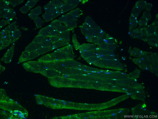 TMSB4X Antibody in Immunohistochemistry (PFA fixed) (IHC (PFA))