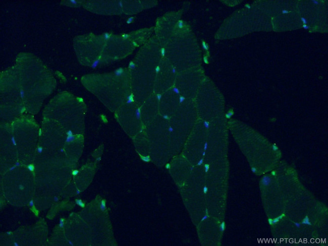 TMSB4X Antibody in Immunohistochemistry (PFA fixed) (IHC (PFA))