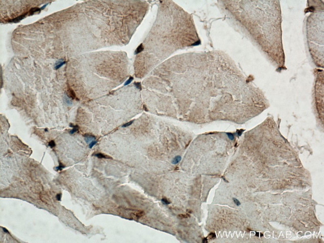 TMSB4X Antibody in Immunohistochemistry (Paraffin) (IHC (P))