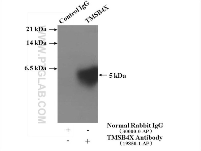 TMSB4X Antibody in Immunoprecipitation (IP)