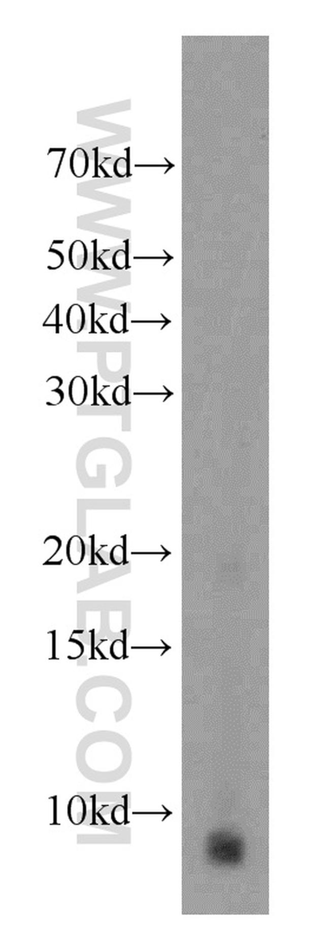 TMSB4X Antibody in Western Blot (WB)