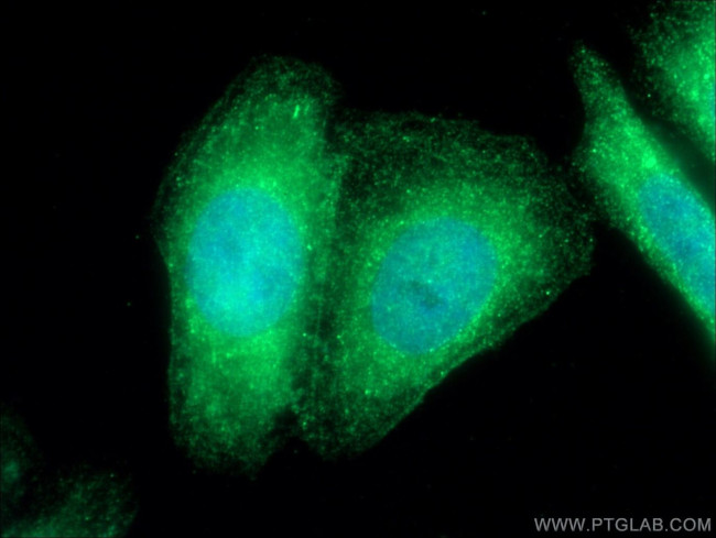 TMEM173/STING Antibody in Immunocytochemistry (ICC/IF)