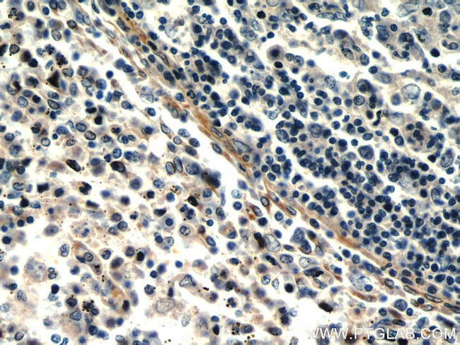 TMEM173/STING Antibody in Immunohistochemistry (Paraffin) (IHC (P))