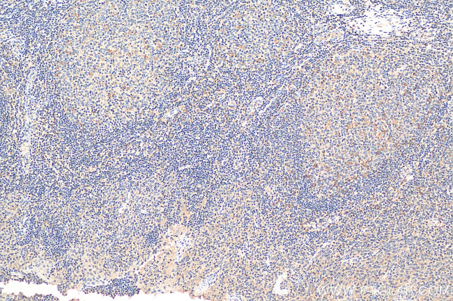 PCM1 Antibody in Immunohistochemistry (Paraffin) (IHC (P))