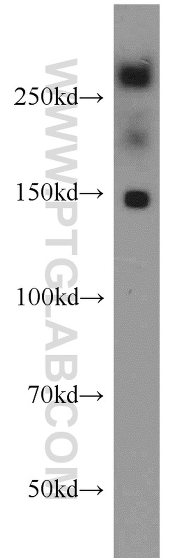 PCM1 Antibody in Western Blot (WB)