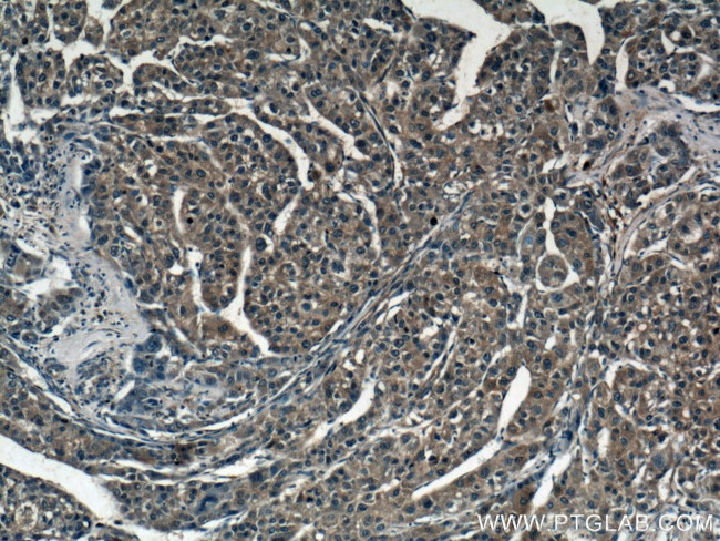 Spermidine synthase Antibody in Immunohistochemistry (Paraffin) (IHC (P))