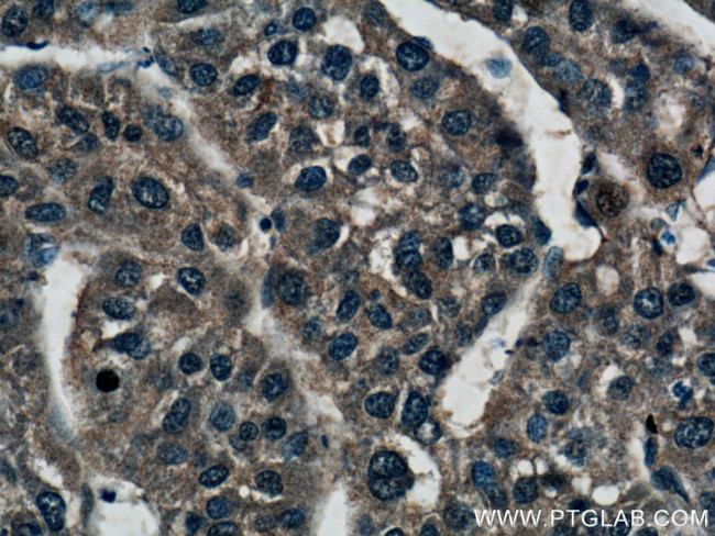 Spermidine synthase Antibody in Immunohistochemistry (Paraffin) (IHC (P))