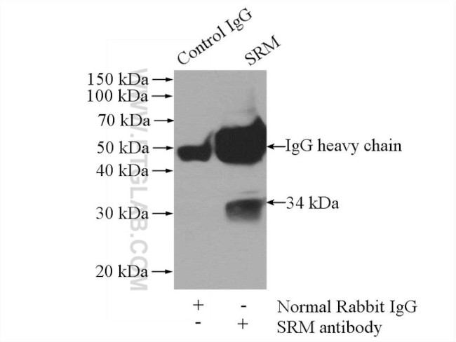 Spermidine synthase Antibody in Immunoprecipitation (IP)