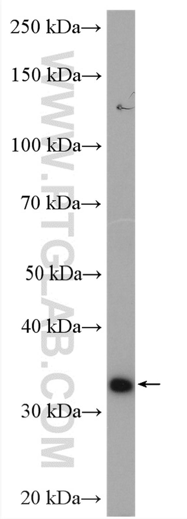 Spermidine synthase Antibody in Western Blot (WB)