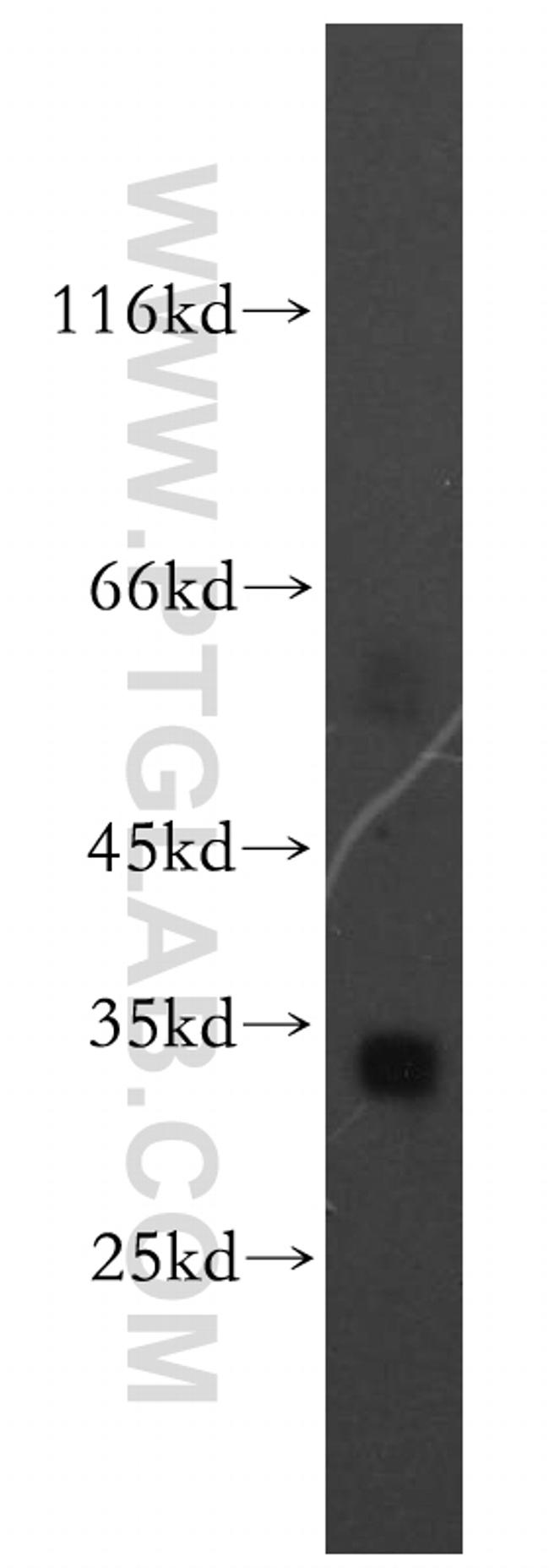 Spermidine synthase Antibody in Western Blot (WB)