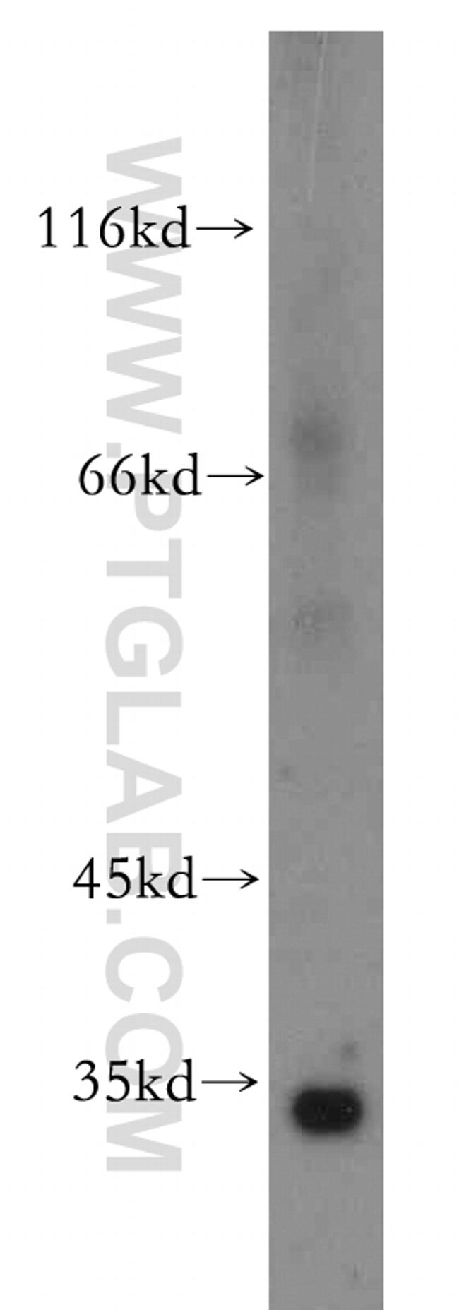 Spermidine synthase Antibody in Western Blot (WB)