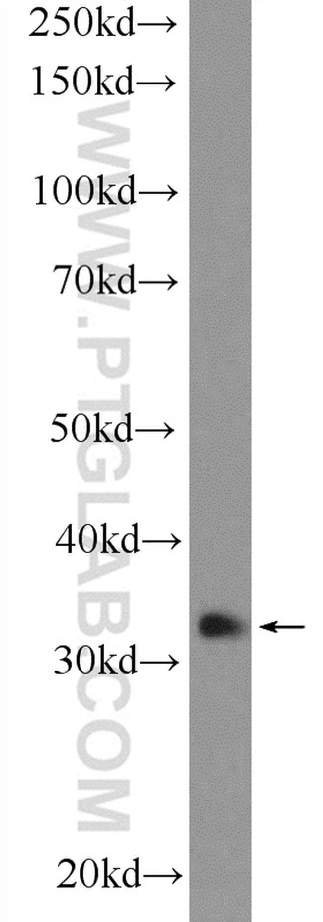 GTF2H3 Antibody in Western Blot (WB)