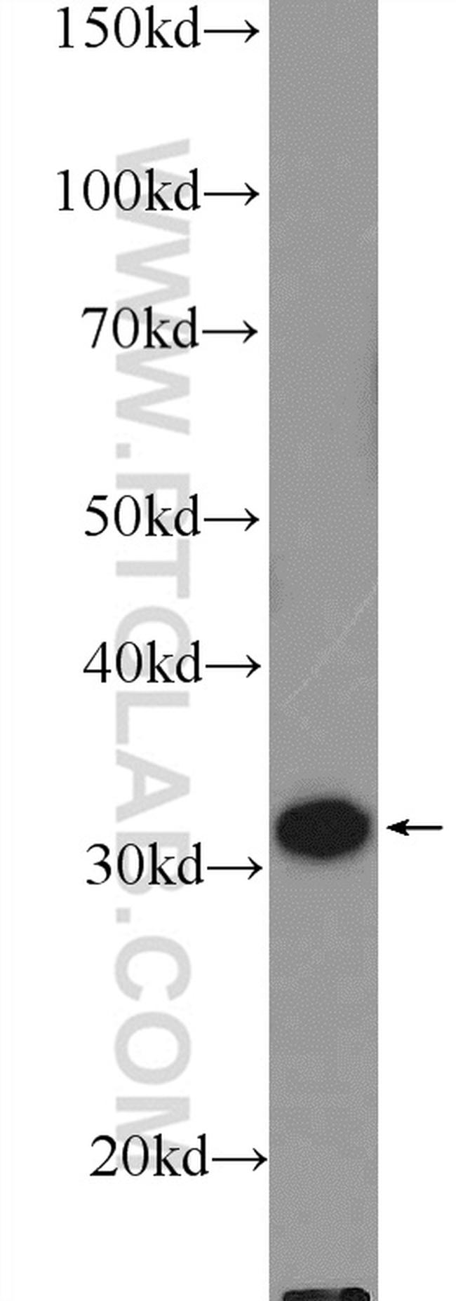 GTF2H3 Antibody in Western Blot (WB)