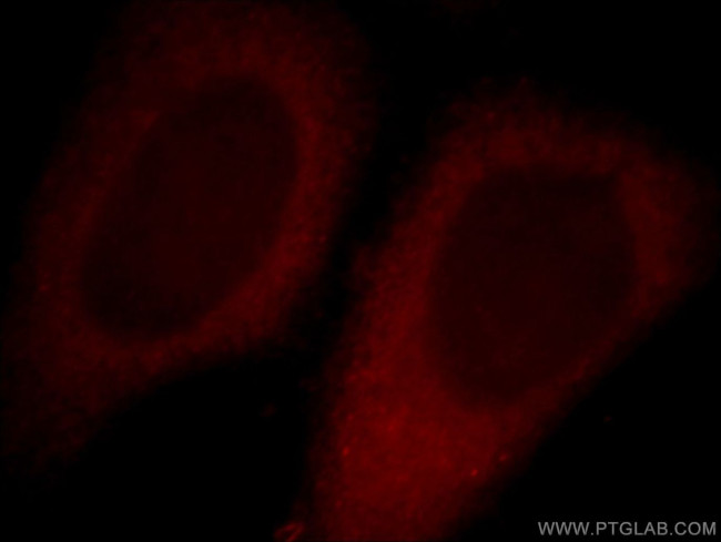 ALKBH4 Antibody in Immunocytochemistry (ICC/IF)