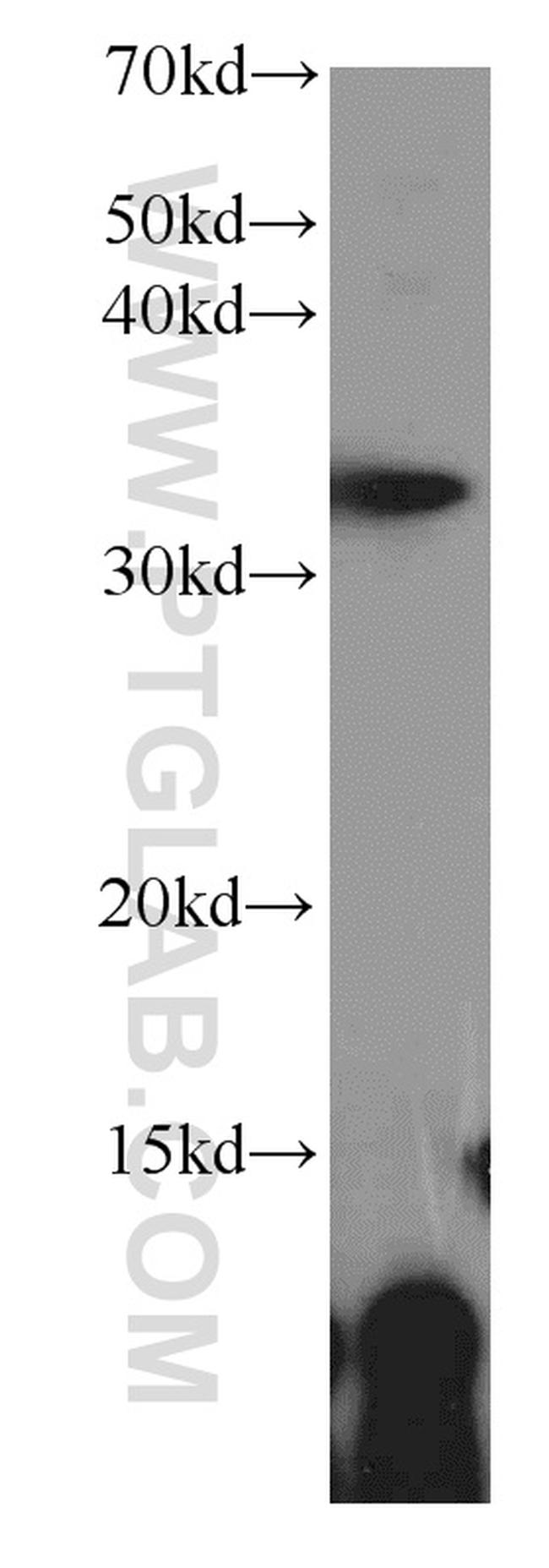 ALKBH4 Antibody in Western Blot (WB)