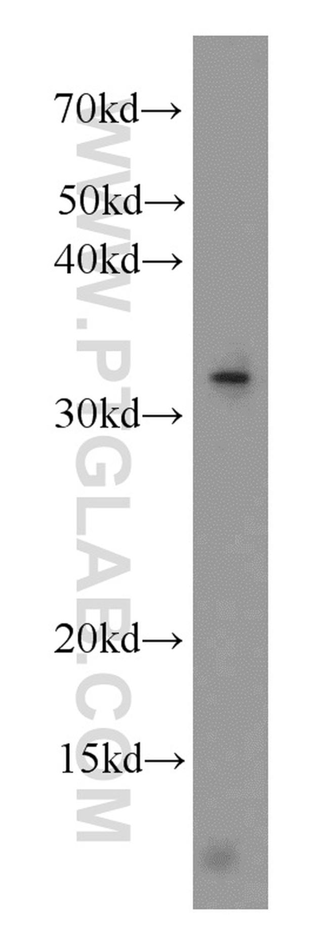 ALKBH4 Antibody in Western Blot (WB)