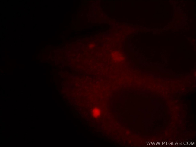 APPL1 Antibody in Immunocytochemistry (ICC/IF)