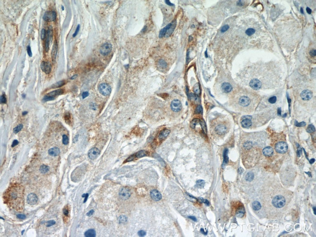 APPL1 Antibody in Immunohistochemistry (Paraffin) (IHC (P))