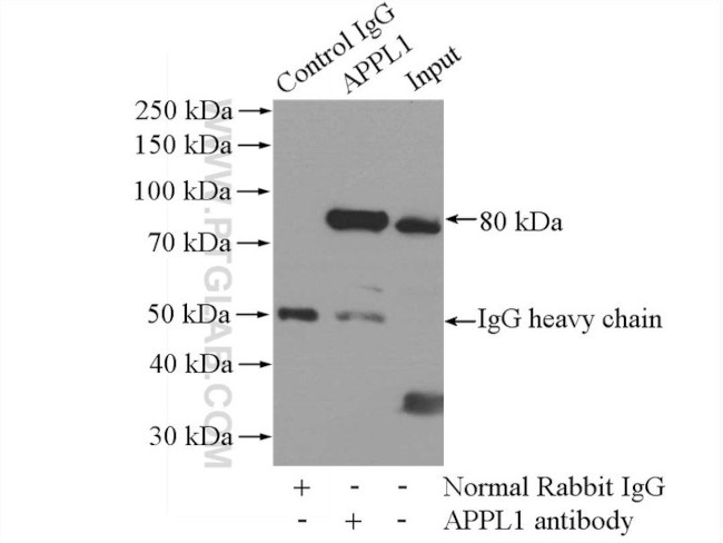 APPL1 Antibody in Immunoprecipitation (IP)