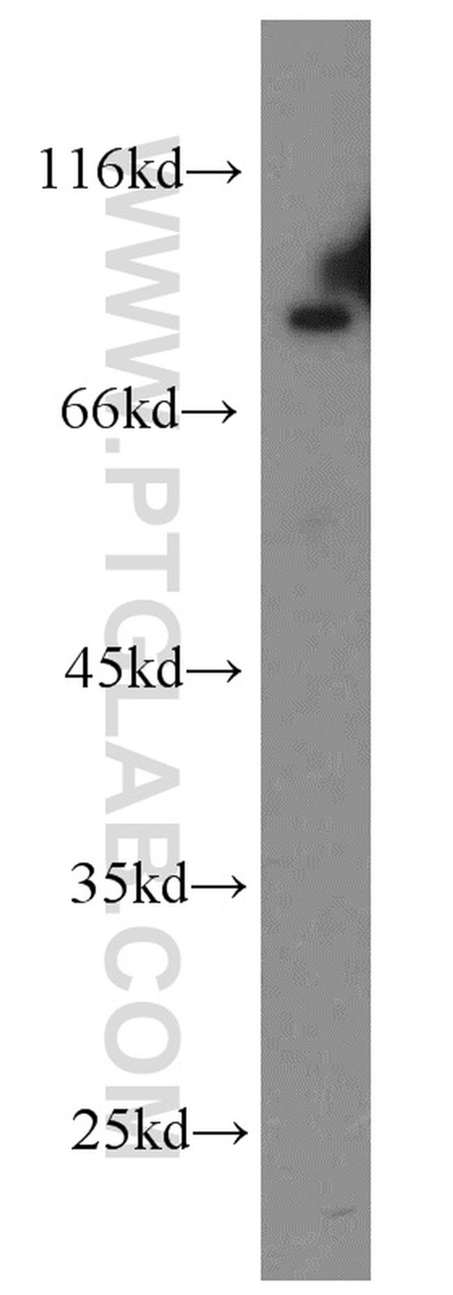 APPL1 Antibody in Western Blot (WB)