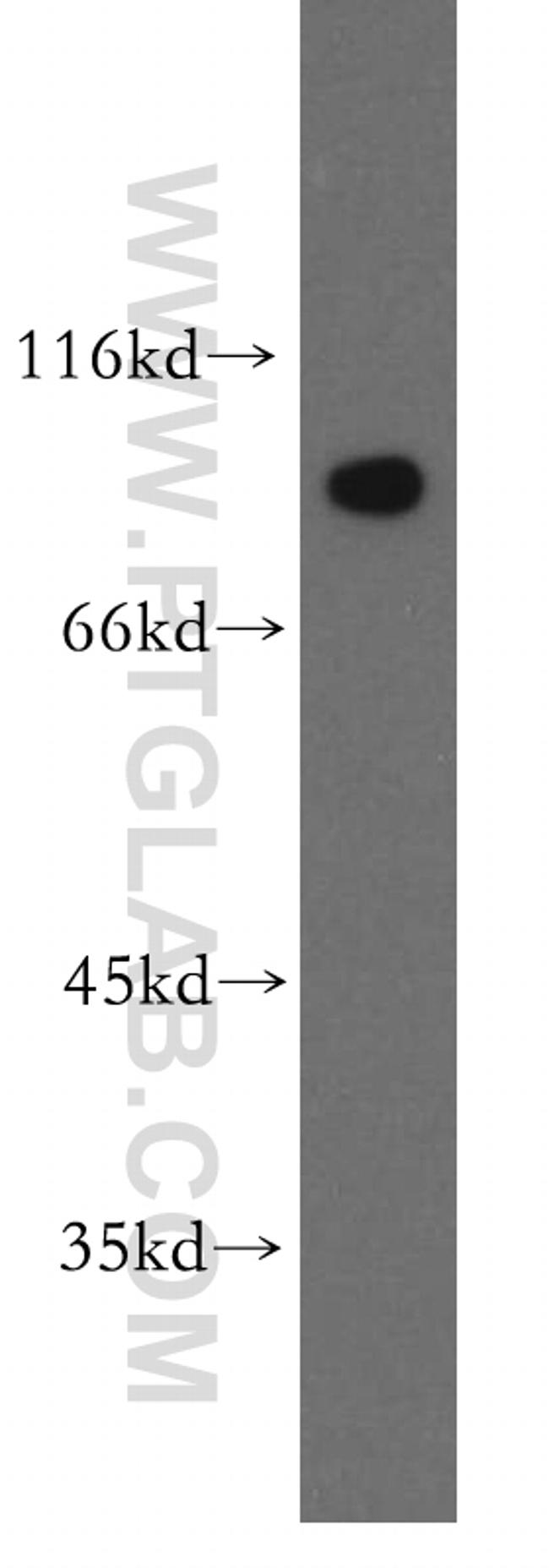 APPL1 Antibody in Western Blot (WB)