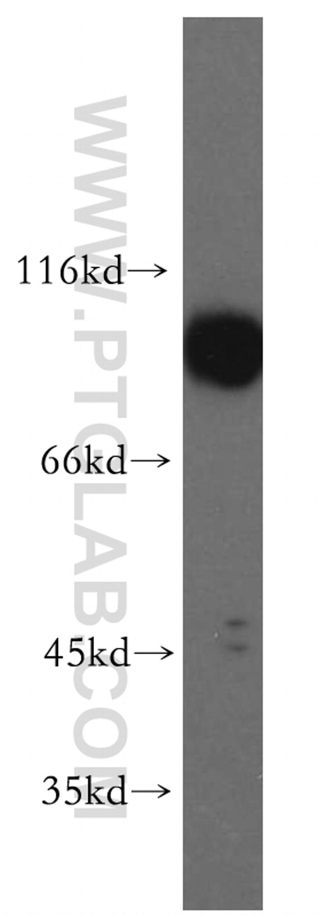 APPL1 Antibody in Western Blot (WB)