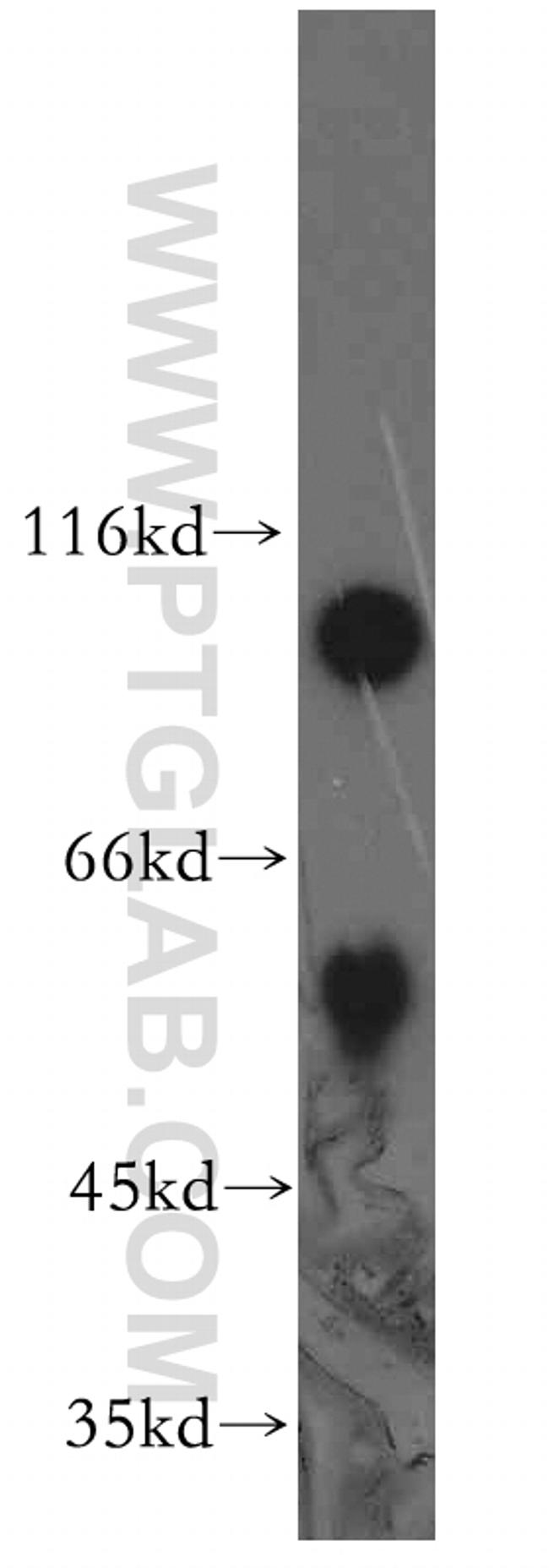 APPL1 Antibody in Western Blot (WB)