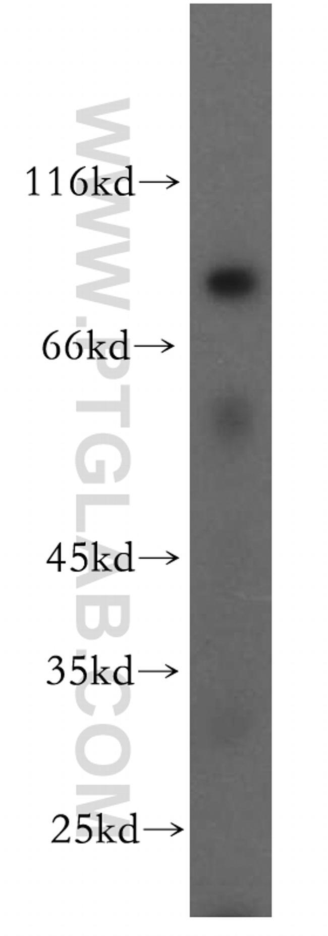 APPL1 Antibody in Western Blot (WB)