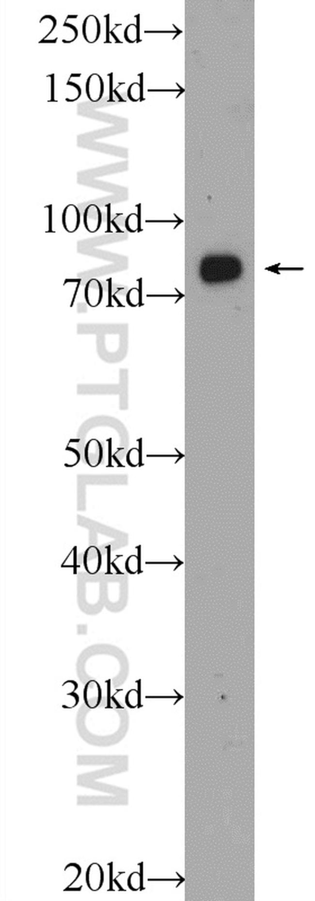 APPL1 Antibody in Western Blot (WB)