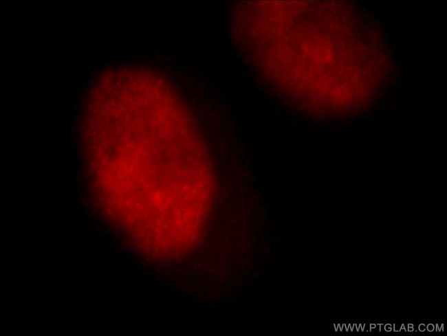 ILF3 Antibody in Immunocytochemistry (ICC/IF)