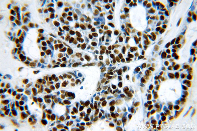 ILF3 Antibody in Immunohistochemistry (Paraffin) (IHC (P))