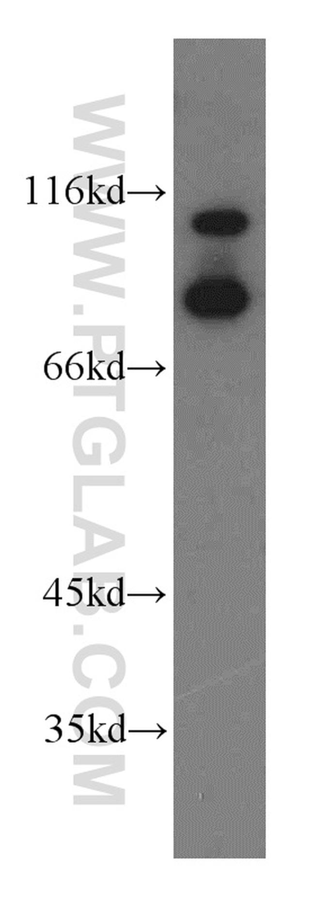 ILF3 Antibody in Western Blot (WB)