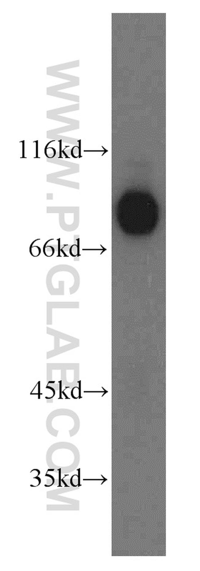 ILF3 Antibody in Western Blot (WB)