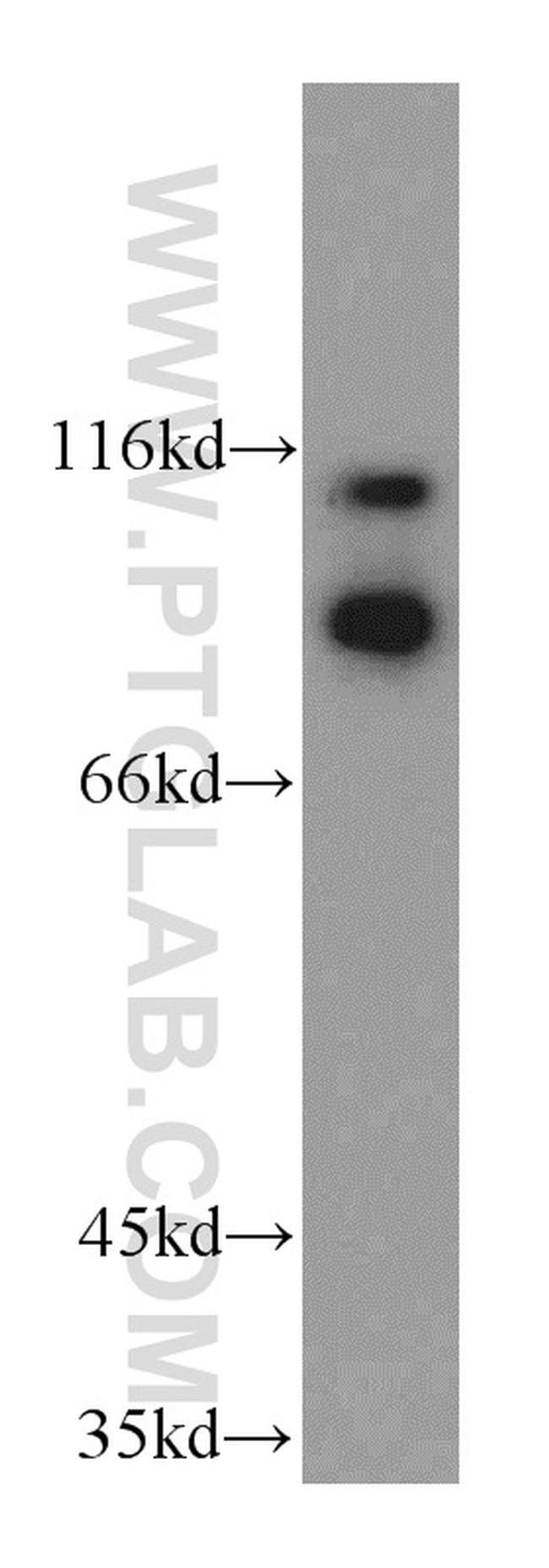 ILF3 Antibody in Western Blot (WB)