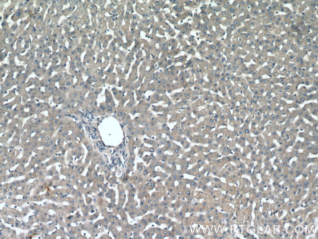 NPC2 Antibody in Immunohistochemistry (Paraffin) (IHC (P))