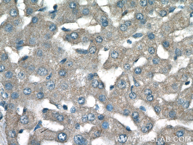 NPC2 Antibody in Immunohistochemistry (Paraffin) (IHC (P))