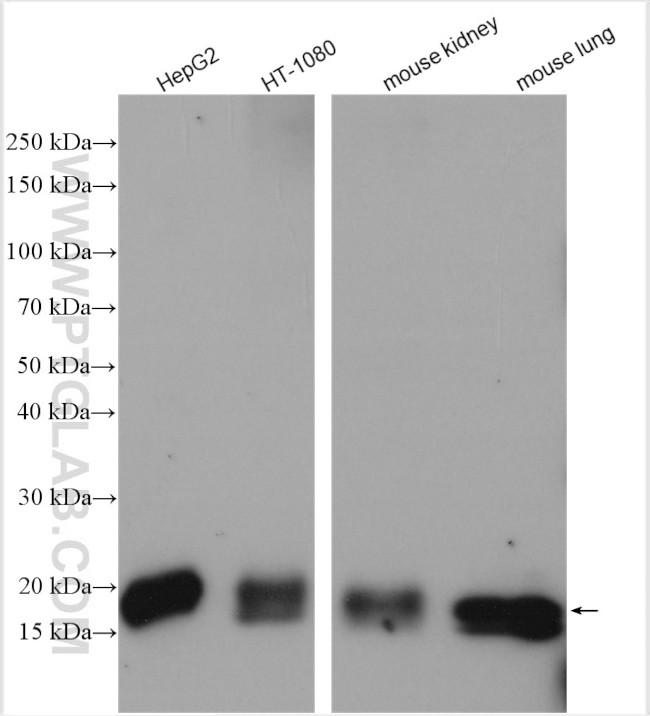 NPC2 Antibody in Western Blot (WB)