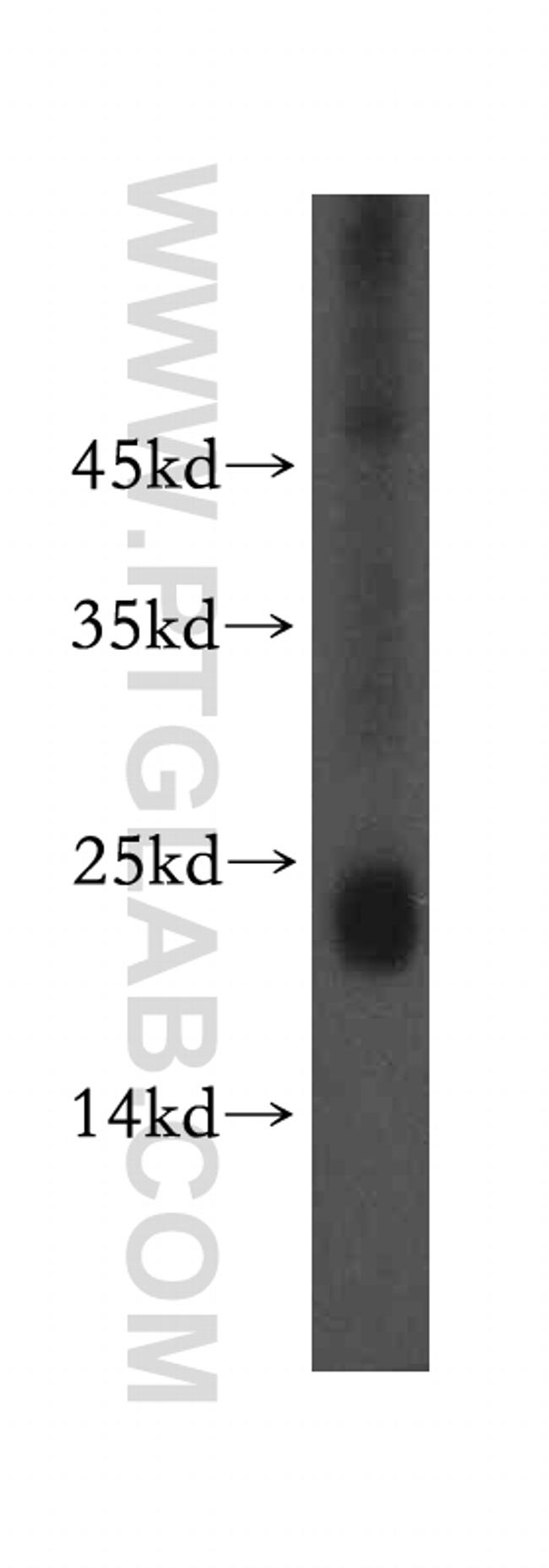 NPC2 Antibody in Western Blot (WB)