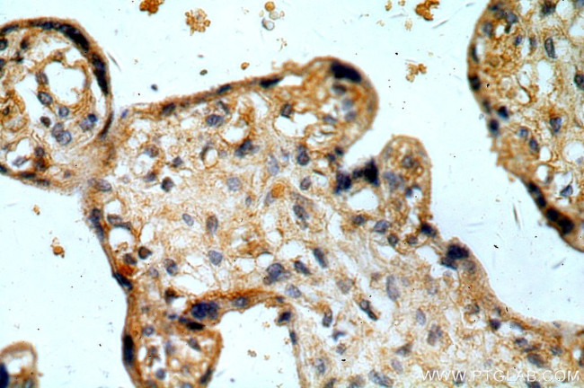 TRUB2 Antibody in Immunohistochemistry (Paraffin) (IHC (P))