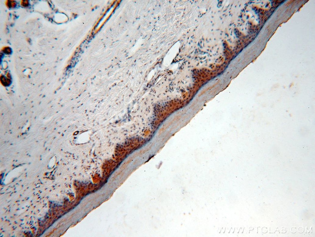 TRUB2 Antibody in Immunohistochemistry (Paraffin) (IHC (P))