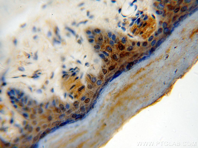 TRUB2 Antibody in Immunohistochemistry (Paraffin) (IHC (P))