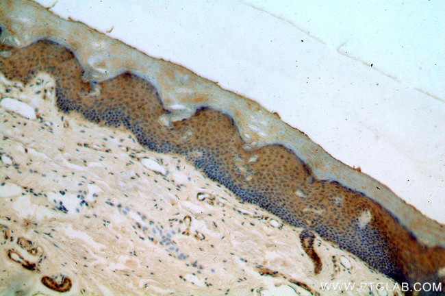 TRUB2 Antibody in Immunohistochemistry (Paraffin) (IHC (P))